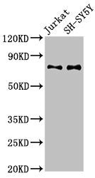 Western Blot  | Positive WB detected in: Jurkat whole cell lysate, SH-SY5Y whole cell lysate  | All lanes: RAVER2 antibody at 3µg/ml  | Secondary  | Goat polyclonal to rabbit IgG at 1/50000 dilution  | Predicted band size: 75, 73 kDa  | Observed band size: 75 kDaRabbit anti-Human RAVER2 Polyclonal Antibody