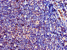 Immunohistochemistry of paraffin-embedded human lymph node tissue using CD209 Antibody at dilution of 1:100Rabbit anti-Human CD209 Polyclonal Antibody