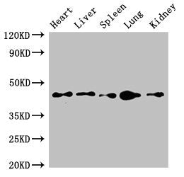 Western Blot | Positive WB detected in: Mouse heart tissue, Mouse liver tissue, Mouse spleen tissue, Mouse lung tissue, Mouse kidney tissue | All lanes: CD209 antibody at 4μg/ml | Secondary | Goat polyclonal to rabbit IgG at 1/50000 dilution | Predicted band size: 46, 36, 19, 44, 42, 31, 5, 38, 34 kDa | Observed band size: 46 kDaRabbit anti-Human CD209 Polyclonal Antibody
