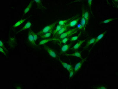Immunofluorescence staining of Hela cells with MID1IP1 Antibody at 1:125, counter-stained with DAPI. The cells were fixed in 4% formaldehyde, permeabilized using 0.2% Triton X-100 and blocked in 10% normal Goat Serum. The cells were then incubated with the antibody overnight at 4°C. The secondary antibody was Alexa Fluor 488-congugated AffiniPure Goat Anti-Rabbit IgG(H+L).