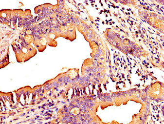IHC image of the antibody diluted at 1:300 and staining in paraffin-embedded human small intestine tissue performed on a Leica BondTM system. After dewaxing and hydration, antigen retrieval was mediated by high pressure in a citrate buffer (pH 6.0). Section was blocked with 10% normal goat serum 30min at RT. Then primary antibody (1% BSA) was incubated at 4°C overnight. The primary is detected by a biotinylated secondary antibody and visualized using an HRP conjugated SP system.