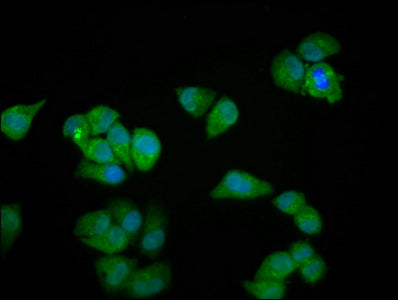 Immunofluorescence staining of Hela cells with MYOZ2 Antibody at 1:100, counter-stained with DAPI. The cells were fixed in 4% formaldehyde, permeabilized using 0.2% Triton X-100 and blocked in 10% normal Goat Serum. The cells were then incubated with the antibody overnight at 4°C. The secondary antibody was Alexa Fluor 488-congugated AffiniPure Goat Anti-Rabbit IgG(H+L).