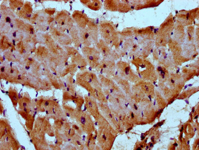 IHC image of MYOZ2 Antibody diluted at 1:300 and staining in paraffin-embedded human heart tissue performed on a Leica BondTM system. After dewaxing and hydration, antigen retrieval was mediated by high pressure in a citrate buffer (pH 6.0). Section was blocked with 10% normal goat serum 30min at RT. Then primary antibody (1% BSA) was incubated at 4°C overnight. The primary is detected by a biotinylated secondary antibody and visualized using an HRP conjugated SP system.