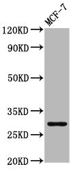Western Blot  | Positive WB detected in: MCF-7 whole cell lysate  | All lanes: MYOZ2 antibody at 4.31µg/ml  | Secondary  | Goat polyclonal to rabbit IgG at 1/50000 dilution  | Predicted band size: 30 kDa  | Observed band size: 30 kDa