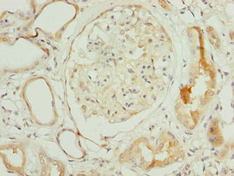 Immunohistochemistry of paraffin-embedded human kidney tissue using NOP10 Antibody at dilution of 1:100Rabbit anti-Human NOP10 Polyclonal Antibody