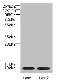Western blot  | All lanes: NOP10 antibody at 4µg/ml  | Lane 1: Jurkat whole cell lysate  | Lane 2: Caco-2 whole cell lysate  | Secondary  | Goat polyclonal to rabbit IgG at 1/10000 dilution  | Predicted band size: 8 kDa  | Observed band size: 8 kDaRabbit anti-Human NOP10 Polyclonal Antibody