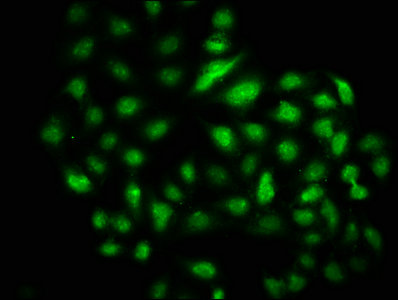 Immunofluorescence staining of Hela cells with DMAP1 Antibody at 1:133, counter-stained with DAPI. The cells were fixed in 4% formaldehyde, permeabilized using 0.2% Triton X-100 and blocked in 10% normal Goat Serum. The cells were then incubated with the antibody overnight at 4°C. The secondary antibody was Alexa Fluor 488-congugated AffiniPure Goat Anti-Rabbit IgG(H+L).Rabbit anti-Human DMAP1 Polyclonal Antibody