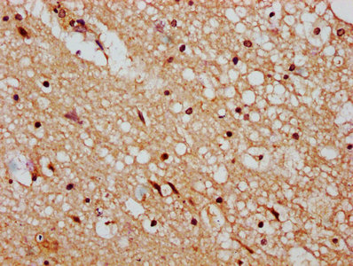 IHC image of DMAP1 Antibody diluted at 1:400 and staining in paraffin-embedded human brain tissue performed on a Leica BondTM system. After dewaxing and hydration, antigen retrieval was mediated by high pressure in a citrate buffer (pH 6.0). Section was blocked with 10% normal goat serum 30min at RT. Then primary antibody (1% BSA) was incubated at 4°C overnight. The primary is detected by a biotinylated secondary antibody and visualized using an HRP conjugated SP system.Rabbit anti-Human DMAP1 Polyclonal Antibody