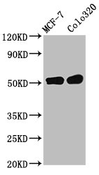 Western Blot  | Positive WB detected in: MCF-7 whole cell lysate, Colo320 whole cell lysate  | All lanes: DMAP1 antibody at 11µg/ml  | Secondary  | Goat polyclonal to rabbit IgG at 1/50000 dilution  | Predicted band size: 53 kDa  | Observed band size: 53 kDaRabbit anti-Human DMAP1 Polyclonal Antibody