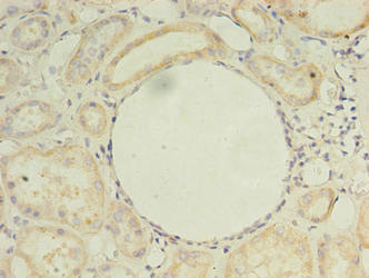 Immunohistochemistry of paraffin-embedded human kidney tissue using ZDHHC4 Antibody at dilution of 1:100Rabbit anti-Human ZDHHC4 Polyclonal Antibody