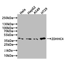 Western blot  | All lanes: ZDHHC4 antibody at 1.5µg/ml + Mouse liver tissue  | Secondary  | Goat polyclonal to rabbit IgG at 1/10000 dilution  | Predicted band size: 40 kDa  | Observed band size: 40 kDaRabbit anti-Human ZDHHC4 Polyclonal Antibody