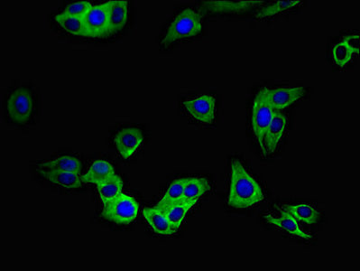 Immunofluorescent analysis of HepG2 cells using SLC52A3 Antibody at dilution of 1:100 and Alexa Fluor 488-congugated AffiniPure Goat Anti-Rabbit IgG(H+L)Rabbit anti-Human SLC52A3 Polyclonal Antibody