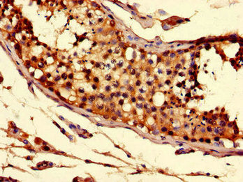 Immunohistochemistry of paraffin-embedded human testis tissue using SLC52A3 Antibody at dilution of 1:100Rabbit anti-Human SLC52A3 Polyclonal Antibody