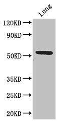 Western Blot | Positive WB detected in: Mouse lung tissue | All lanes: Q9NQ4 antibody at 3.2μg/ml | Secondary | Goat polyclonal to rabbit IgG at 1/50000 dilution | Predicted band size: 51, 46 kDa | Observed band size: 51 kDaRabbit anti-Human SLC52A3 Polyclonal Antibody