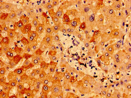 Immunohistochemistry of paraffin-embedded human liver tissue using IFT46 Antibody at dilution of 1:100Rabbit anti-Human IFT46 Polyclonal Antibody