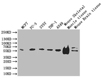 Western BlotPositive WB detected in: MCF7 whole cell lysate, PC-3 whole cell lysate, SY5Y whole cell lysate, THP-1 whole cell lysate, A549 whole cell lysate, Mouse Sketetal Muscle tissue lysate, Mouse Brain tissue lysate All lanes: ZDHHC12 antibody at 1:1000SecondaryGoat polyclonal to rabbit IgG at 1/50000 dilutionPredicted band size: 35/41 kDaObserved band size: 55 kDaRabbit anti-Human IFT46 Polyclonal Antibody