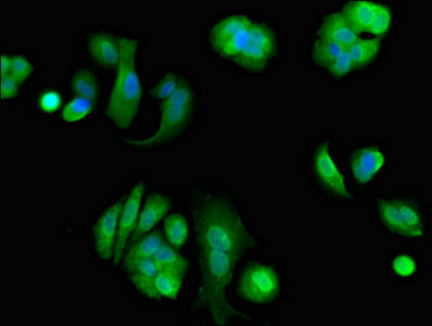 Immunofluorescent analysis of MCF-7 cells using EIF4ENIF1 Antibody at dilution of 1:100 and Alexa Fluor 488-congugated AffiniPure Goat Anti-Rabbit IgG(H+L)Rabbit anti-Human EIF4ENIF1 Polyclonal Antibody