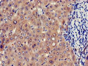 Immunohistochemistry of paraffin-embedded human liver tissue using EIF4ENIF1 Antibody at dilution of 1:100Rabbit anti-Human EIF4ENIF1 Polyclonal Antibody