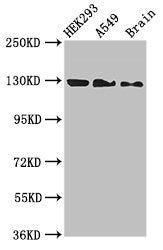 Western Blot  | Positive WB detected in: HEK293 whole cell lysate, A549 whole cell lysate, Mouse brain tissue  | All lanes: EIF4ENIF1 antibody at 2.7µg/ml  | Secondary  | Goat polyclonal to rabbit IgG at 1/50000 dilution  | Predicted band size: 109, 89 kDa  | Observed band size: 130 kDaRabbit anti-Human EIF4ENIF1 Polyclonal Antibody