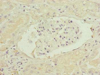 Immunohistochemistry of paraffin-embedded human kidney tissue using FBXO6 Antibody at dilution of 1:100Rabbit anti-Human FBXO6 Polyclonal Antibody