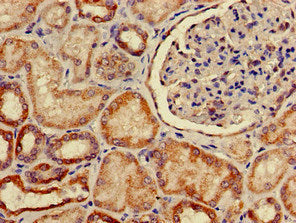 Immunohistochemistry of paraffin-embedded human kidney tissue using SLC2A9 Antibody at dilution of 1:100Rabbit anti-Human SLC2A9 Polyclonal Antibody
