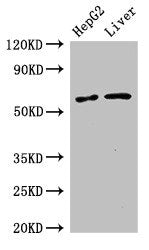 Western Blot  | Positive WB detected in: HepG2 whole cell lysate, Mouse liver tissue  | All lanes: SLC2A9 antibody at 2.7µg/ml  | Secondary  | Goat polyclonal to rabbit IgG at 1/50000 dilution  | Predicted band size: 59, 56 kDa  | Observed band size: 59 kDaRabbit anti-Human SLC2A9 Polyclonal Antibody