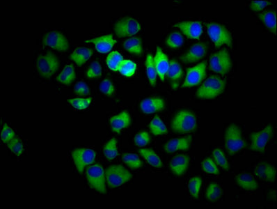 Immunofluorescence staining of Hela cells with INPP5E Antibody at 1:133, counter-stained with DAPI. The cells were fixed in 4% formaldehyde, permeabilized using 0.2% Triton X-100 and blocked in 10% normal Goat Serum. The cells were then incubated with the antibody overnight at 4°C. The secondary antibody was Alexa Fluor 488-congugated AffiniPure Goat Anti-Rabbit IgG(H+L).