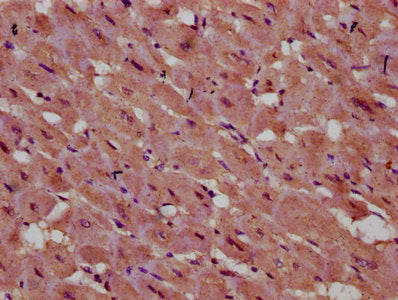 IHC image of INPP5E Antibody diluted at 1:400 and staining in paraffin-embedded human heart tissue performed on a Leica BondTM system. After dewaxing and hydration, antigen retrieval was mediated by high pressure in a citrate buffer (pH 6.0). Section was blocked with 10% normal goat serum 30min at RT. Then primary antibody (1% BSA) was incubated at 4°C overnight. The primary is detected by a biotinylated secondary antibody and visualized using an HRP conjugated SP system.