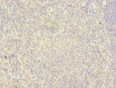 Immunohistochemistry of paraffin-embedded human tonsil tissue using RAB6B Antibody at dilution of 1:100Rabbit anti-Human RAB6B Polyclonal Antibody