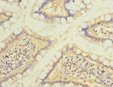 Immunohistochemistry of paraffin-embedded human small intestine tissue using RAB6B Antibody at dilution of 1:100Rabbit anti-Human RAB6B Polyclonal Antibody