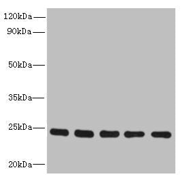 Western blot | All lanes: RAB6B antibody at 5μg/ml | Lane 1: Mouse brain tissue | Lane 2: U251 whole cell lysate | Lane 3: MCF-7 whole cell lysate | Lane 4: A549 whole cell lysate | Lane 5: K562 whole cell lysate | Secondary | Goat polyclonal to rabbit IgG at 1/10000 dilution | Predicted band size: 24, 23 kDa | Observed band size: 24 kDaRabbit anti-Human RAB6B Polyclonal Antibody