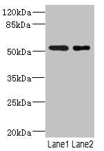 Western blot  | All lanes: RXFP3 antibody at 3.68µg/ml  | Lane 1: Jurkat whole cell lysate  | Lane 2: HepG2 whole cell lysate  | Secondary  | Goat polyclonal to rabbit IgG at 1/10000 dilution  | Predicted band size: 51 kDa  | Observed band size: 51 kDaRabbit anti-Human RXFP3 Polyclonal Antibody