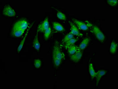 Immunofluorescence staining of Hela cells with CUTC Antibody at 1:133, counter-stained with DAPI. The cells were fixed in 4% formaldehyde, permeabilized using 0.2% Triton X-100 and blocked in 10% normal Goat Serum. The cells were then incubated with the antibody overnight at 4°C. The secondary antibody was Alexa Fluor 488-congugated AffiniPure Goat Anti-Rabbit IgG(H+L).Rabbit anti-Human CUTC Polyclonal Antibody