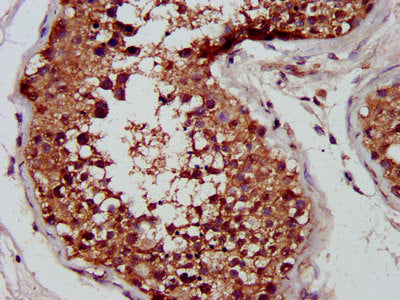 IHC image of CUTC Antibody diluted at 1:400 and staining in paraffin-embedded human testis tissue performed on a Leica BondTM system. After dewaxing and hydration, antigen retrieval was mediated by high pressure in a citrate buffer (pH 6.0). Section was blocked with 10% normal goat serum 30min at RT. Then primary antibody (1% BSA) was incubated at 4°C overnight. The primary is detected by a biotinylated secondary antibody and visualized using an HRP conjugated SP system.Rabbit anti-Human CUTC Polyclonal Antibody