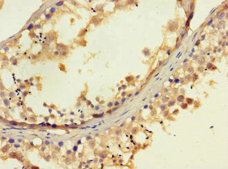 Immunohistochemistry of paraffin-embedded human testis tissue using EXD2 Antibody at dilution of 1:100Rabbit anti-Human EXD2 Polyclonal Antibody