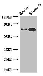 Western Blot | Positive WB detected in: Mouse brain tissue, Mouse stomach tissue | All lanes: EXD2 antibody at 2.8μg/ml | Secondary | Goat polyclonal to rabbit IgG at 1/50000 dilution | Predicted band size: 71, 57 kDa | Observed band size: 71 kDaRabbit anti-Human EXD2 Polyclonal Antibody
