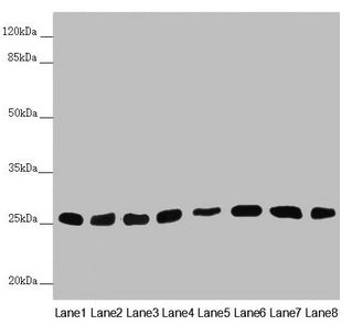 Western blot  | All lanes: CHCHD3 antibody at 0.56µg/ml  | Lane 1: Mouse heart tissue  | Lane 2: Mouse kidney tissue  | Lane 3: Mouse lung tissue  | Lane 4: A549 whole cell lysate  | Lane 5: HepG2 whole cell lysate  | Lane 6: 293T whole cell lysate  | Lane 7: A431 whole cell lysate  | Lane 8: Hela whole cell lysate  | Secondary  | Goat polyclonal to rabbit IgG at 1/10000 dilution  | Predicted band size: 26 kDa  | Observed band size: 26 kDa