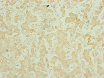 Immunohistochemistry of paraffin-embedded human liver tissue using CHCHD3 Antibody at dilution of 1:100Rabbit anti-Human CHCHD3 Polyclonal Antibody