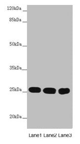 Western blot  | All lanes: CHCHD3 antibody at 1.67µg/ml  | Lane 1: Mouse lung tissue  | Lane 2: HepG2 whole cell lysate  | Lane 3: Hela whole cell lysate  | Secondary  | Goat polyclonal to rabbit IgG at 1/10000 dilution  | Predicted band size: 26 kDa  | Observed band size: 26 kDaRabbit anti-Human CHCHD3 Polyclonal Antibody