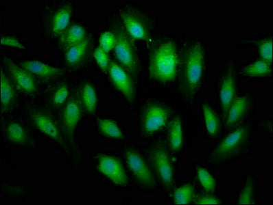 Immunofluorescence staining of Hela cells with BABAM2 Antibody at 1:66, counter-stained with DAPI. The cells were fixed in 4% formaldehyde, permeabilized using 0.2% Triton X-100 and blocked in 10% normal Goat Serum. The cells were then incubated with the antibody overnight at 4°C. The secondary antibody was Alexa Fluor 488-congugated AffiniPure Goat Anti-Rabbit IgG(H+L).