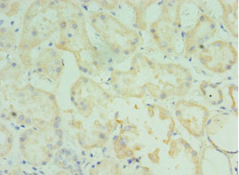 Immunohistochemistry of paraffin-embedded human kidney tissue using TMOD3 Antibody at dilution of 1:100Rabbit anti-Human TMOD3 Polyclonal Antibody