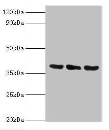 Western blot | All lanes: TMOD3 antibody at 5μg/ml | Lane 1: Jurkat whole cell lysate | Lane 2: MCF-7 whole cell lysate | Lane 3: Hela whole cell lysate | Secondary | Goat polyclonal to rabbit IgG at 1/10000 dilution | Predicted band size: 40 kDa | Observed band size: 40 kDaRabbit anti-Human TMOD3 Polyclonal Antibody