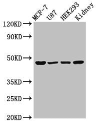 Western Blot  | Positive WB detected in: MCF-7 whole cell lysate, U87 whole cell lysate, HEK293 whole cell lysate, Rat kidney tissue  | All lanes: WWOX antibody at 3µg/ml  | Secondary  | Goat polyclonal to rabbit IgG at 1/50000 dilution  | Predicted band size: 47, 42, 22, 5, 27, 36, 24 kDa  | Observed band size: 47 kDaRabbit anti-Human WWOX Polyclonal Antibody