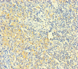Immunohistochemistry of paraffin-embedded human tonsil tissue using the antibody at dilution of 1:100Rabbit anti-Human PLAC8 Polyclonal Antibody