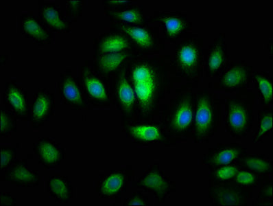 Immunofluorescence staining of A549 cells with SACS Antibody at 1:200, counter-stained with DAPI. The cells were fixed in 4% formaldehyde, permeabilized using 0.2% Triton X-100 and blocked in 10% normal Goat Serum. The cells were then incubated with the antibody overnight at 4°C. The secondary antibody was Alexa Fluor 488-congugated AffiniPure Goat Anti-Rabbit IgG(H+L).Rabbit anti-Human SACS Polyclonal Antibody