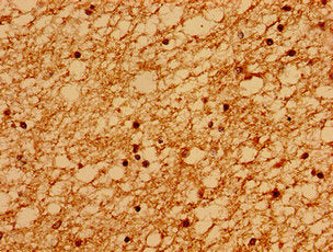 Immunohistochemistry of paraffin-embedded human brain tissue using the antibody at dilution of 1:100Rabbit anti-Human SACS Polyclonal Antibody