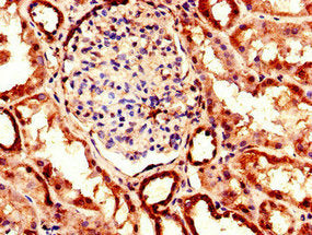 Immunohistochemistry of paraffin-embedded human kidney tissue using EHD2 Antibody at dilution of 1:100Rabbit anti-Human EHD2 Polyclonal Antibody