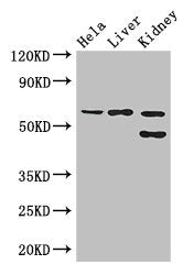 Western Blot | Positive WB detected in: Hela whole cell lysate, Mouse liver tissue, Mouse kidney tissue | All lanes: EHD2 antibody at 3μg/ml | Secondary | Goat polyclonal to rabbit IgG at 1/50000 dilution | Predicted band size: 62, 47 kDa | Observed band size: 62, 47 kDaRabbit anti-Human EHD2 Polyclonal Antibody