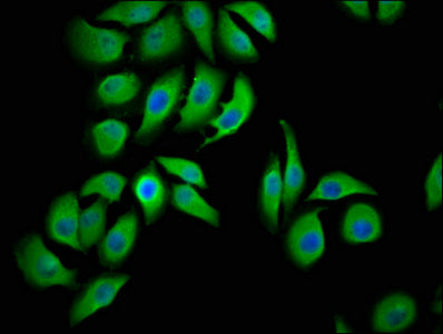 Immunofluorescence staining of A549 cells with LMCD1 Antibody at 1:100, counter-stained with DAPI. The cells were fixed in 4% formaldehyde, permeabilized using 0.2% Triton X-100 and blocked in 10% normal Goat Serum. The cells were then incubated with the antibody overnight at 4°C. The secondary antibody was Alexa Fluor 488-congugated AffiniPure Goat Anti-Rabbit IgG(H+L).