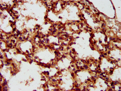 IHC image of the antibody diluted at 1:300 and staining in paraffin-embedded human lung tissue performed on a Leica BondTM system. After dewaxing and hydration, antigen retrieval was mediated by high pressure in a citrate buffer (pH 6.0). Section was blocked with 10% normal goat serum 30min at RT. Then primary antibody (1% BSA) was incubated at 4°C overnight. The primary is detected by a biotinylated secondary antibody and visualized using an HRP conjugated SP system.